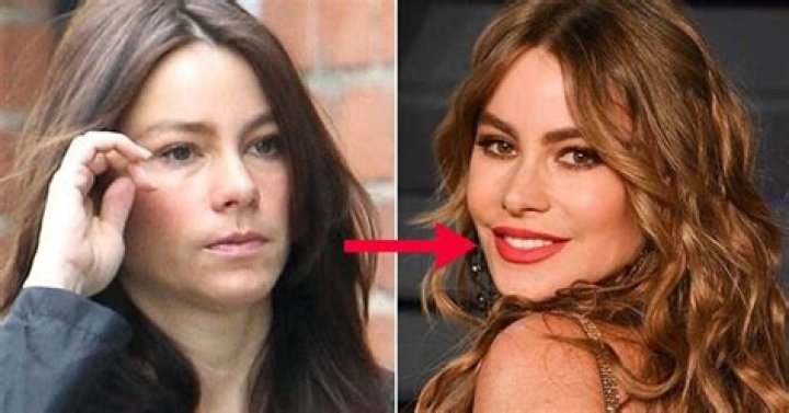 bare-faced celebrities