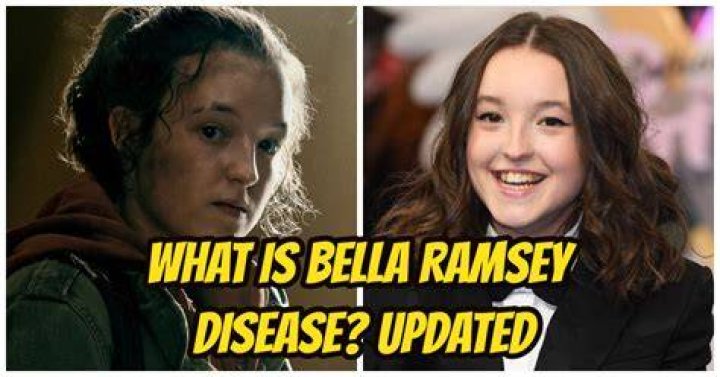 bella ramsey disease