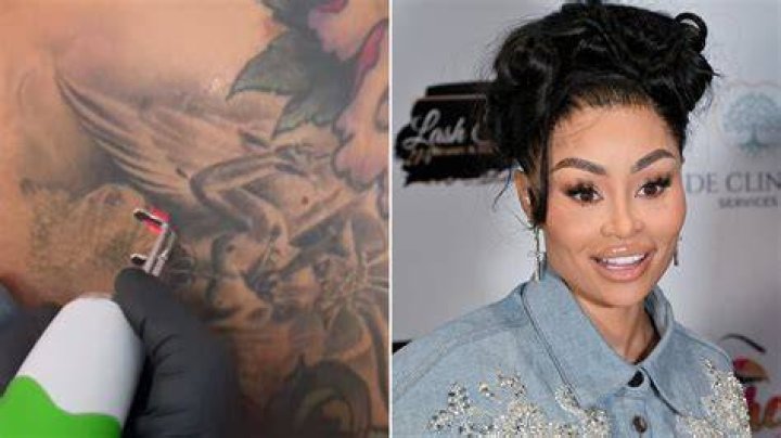 Blac Chyna removes Baphomet tattoo Blac Chyna removes Baphomet tattoo