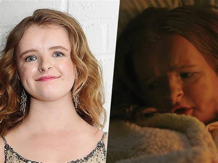 Does Milly Shapiro Have Down Syndrome? Face Condition