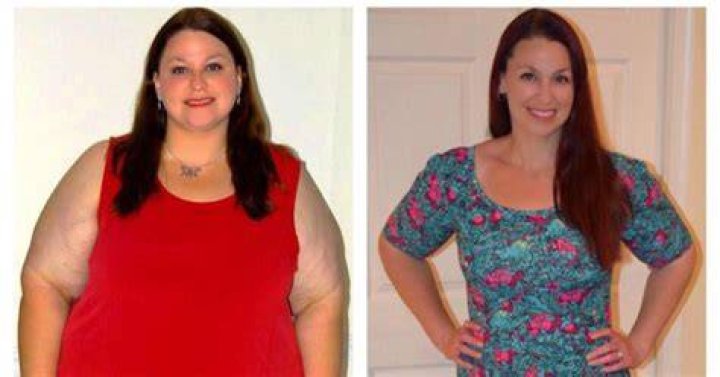 jacqui extreme weight loss now