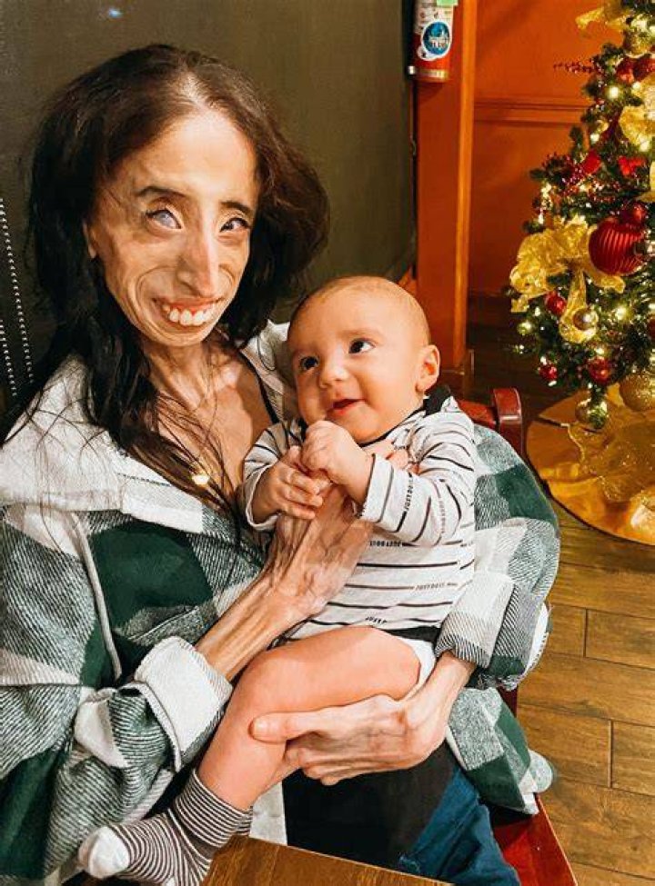 Lizzie Velasquez