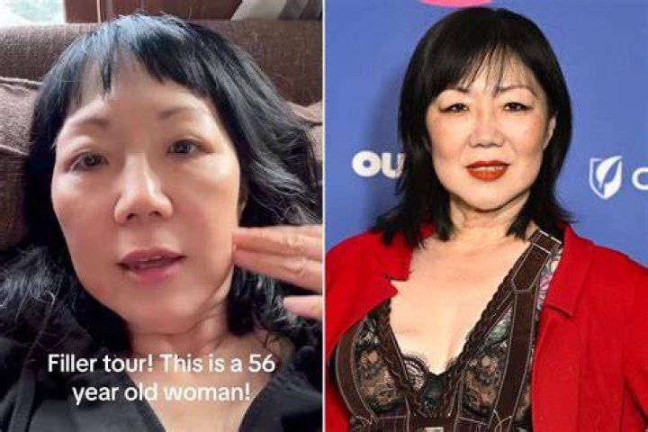 Margaret Cho Plastic Surgery Details