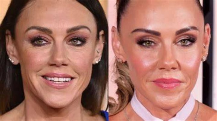 Michelle Heaton Plastic Surgery Before And After: What Happened To Her Face? Michelle Heaton before after