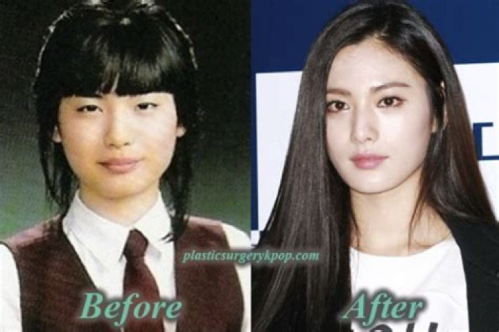 Nana | After School Before Surgery