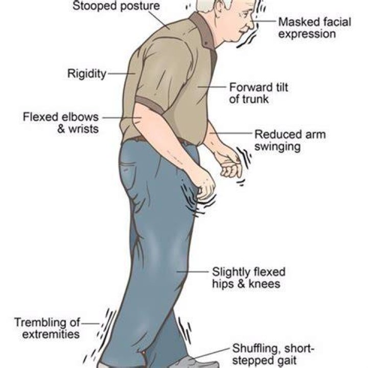 Parkinson's Disease Parkinson's Disease