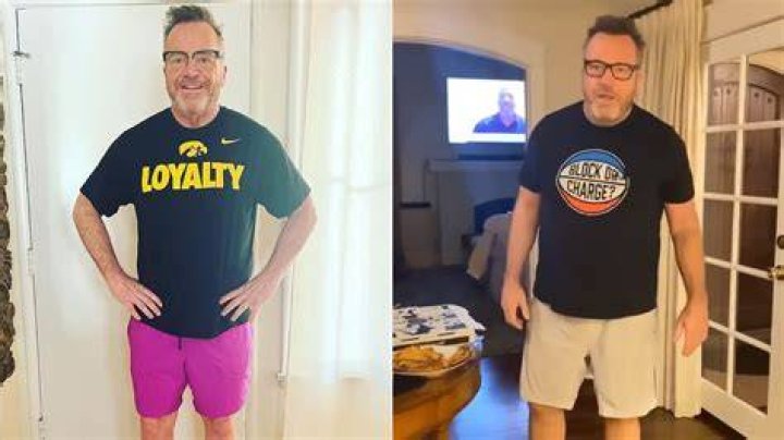 Tom Arnold Plastic Surgery journey