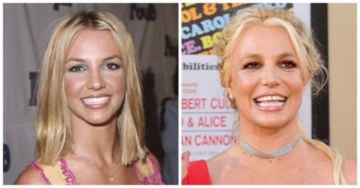 Why Does Britney Spears Have a Gap Tooth? Find out Here!